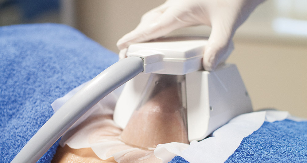 How Fat Freezing and HIFU Work Together? 2 Multiple Areas in One Session HIFU and Fat Freezing West Malling