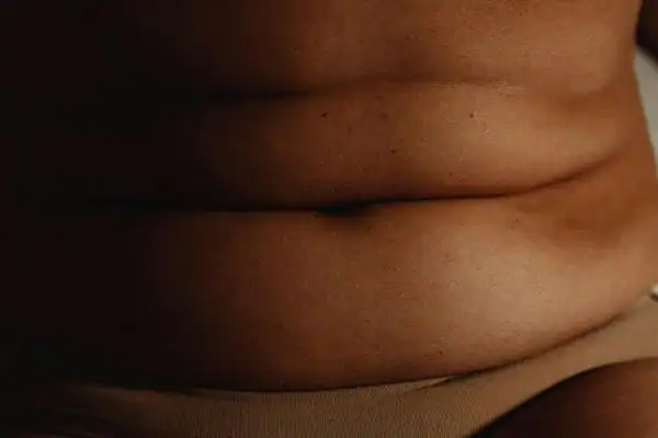 The Hidden Connection: How Stress Shapes Your Fitness and Body Composition 3 image of what stress can do on the stomach area and how Lipo 360 West Malling can help to change your body shape.